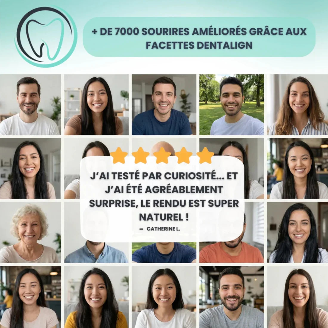Facettes Smile Amovibles - Dentalign™(T-C)