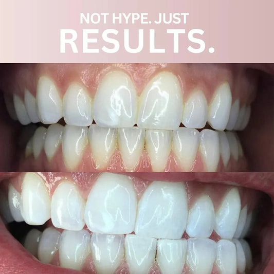 WhiteSmile™ — Bandes de Blanchiment Premium