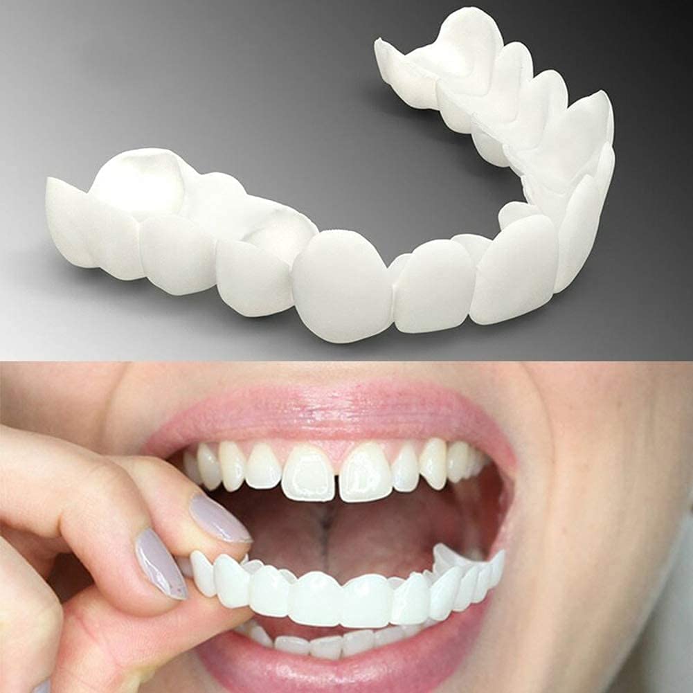 Facettes Amovibles - Dentalign™  Confort et ajustement parfait(F-C)