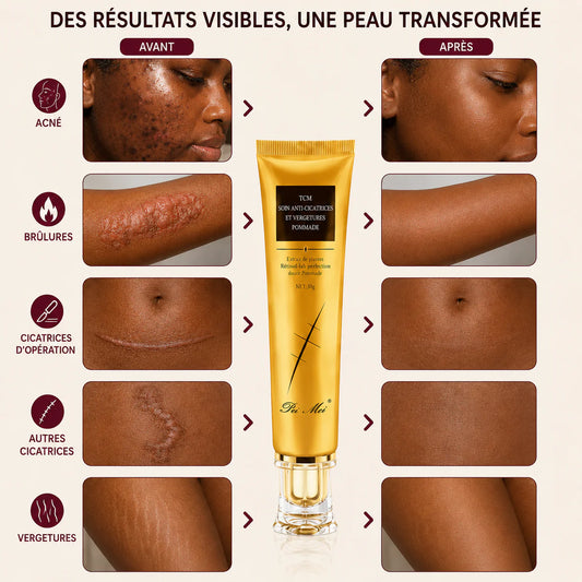 Crème Anti-Imperfection ; Réparatrice Anti-Cicatrices & VERGETURES