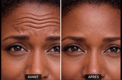 Retinol Cream - Crème Visage - Anti-Age - Anti Rides - Peaux à tendance acnéique. 1 acheté= 1 Offert