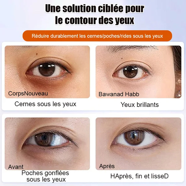 Sérum Contour des Yeux – Anti-Rides (T-O)