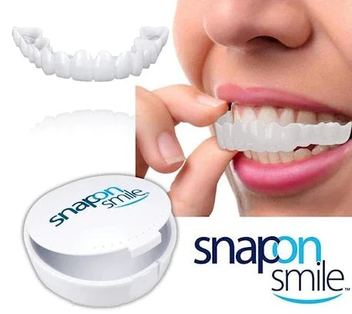 Facettes Amovibles - Dentalign™  Confort et ajustement parfait(F-C)