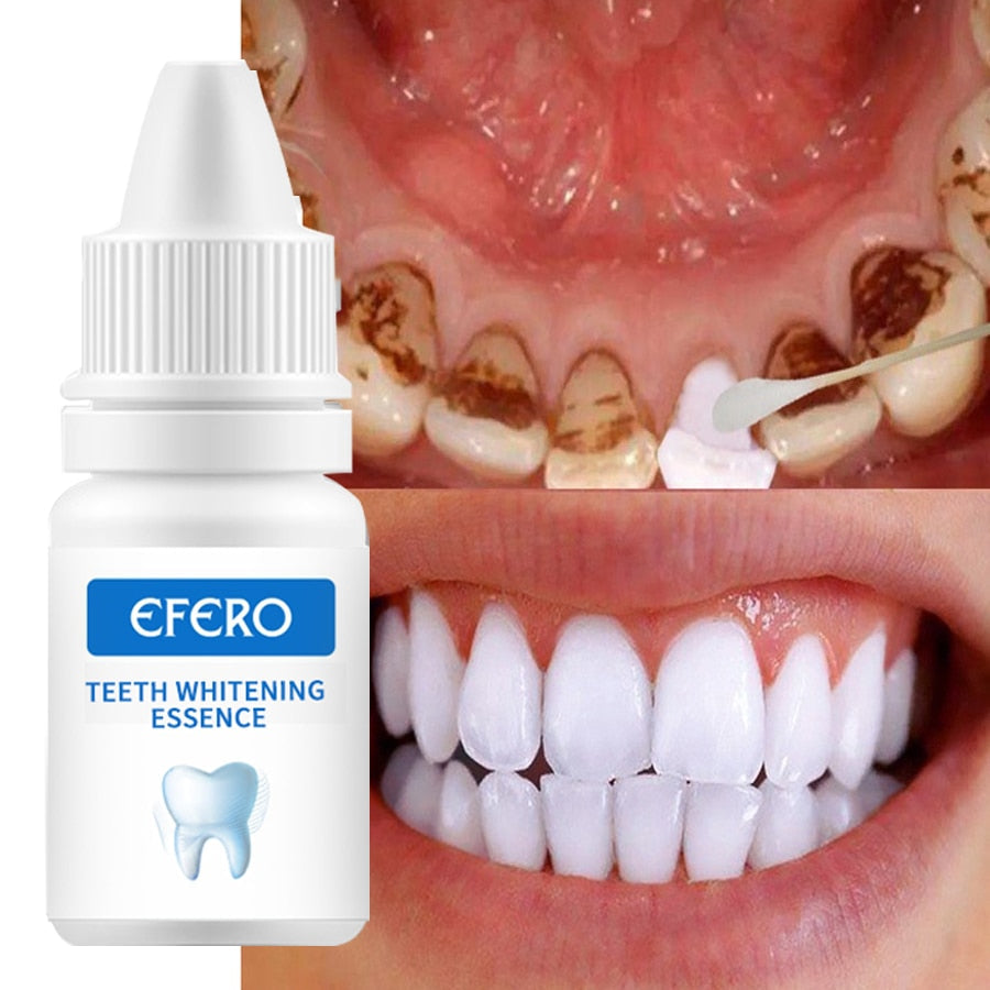 EFFERO™ – Le Blanchiment Dentaire Révolutionnaire à Domicile