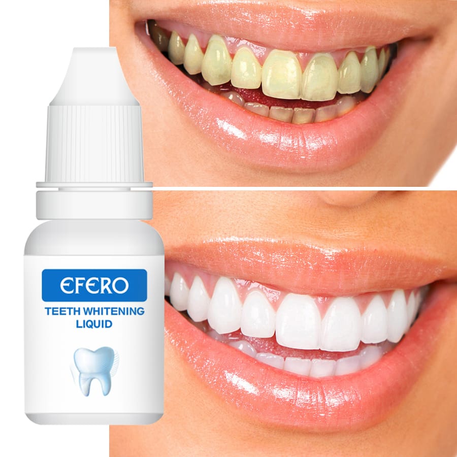 EFFERO™ – Le Blanchiment Dentaire Révolutionnaire à Domicile