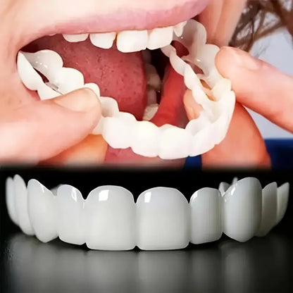 Facettes Amovibles - Dentalign™  Confort et ajustement parfait(F-C)
