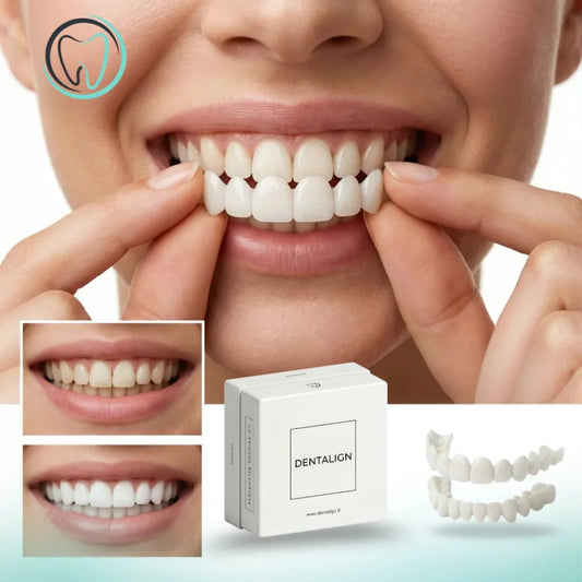 Facettes Smile Amovibles - Dentalign™